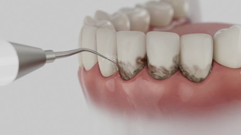 Trusted Teeth Cleaning And Checkup service in Fairhope, AL - Dentist Open Now
